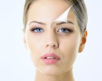 Two halves of a woman's face showing improvement in skin texture