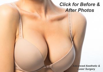 My breasts are extremely pointy after my breast aumentation, will