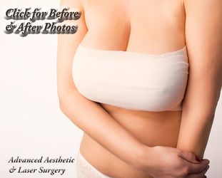 Breast Augmentation Surgery: The Solution To Small Breasts