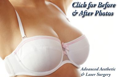 What To Do With Old Silicone Gel Breast Implants Columbus OH