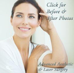 Brow Lift with Advanced Aesthetic & Laser Surgery