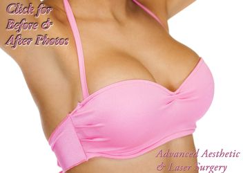 Why do breast implants look fake?